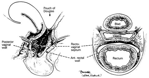 vagina nude|Category : Human surface anatomy of vulva